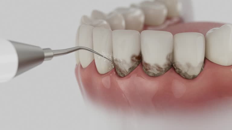 Trusted Dental Crowns And Bridges service in Hershey, PA - Dentist Open Now